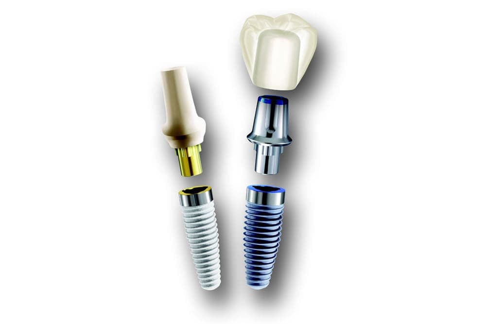 インプラント(口腔外科)