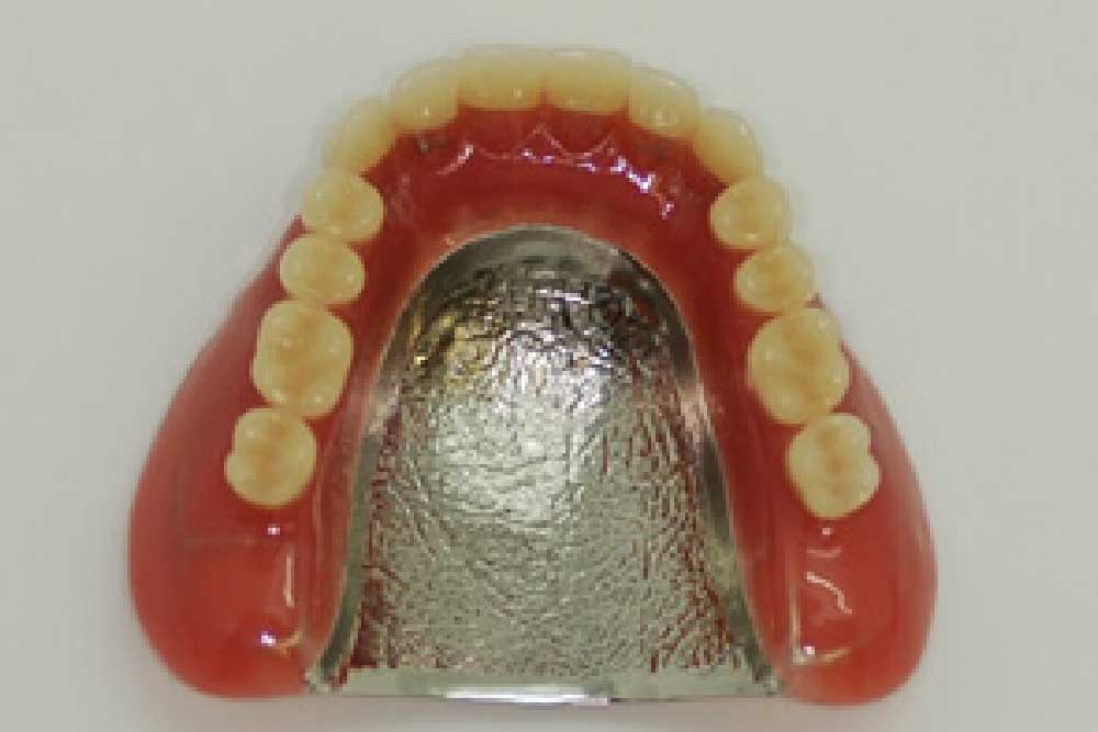 総入れ歯 - 金属床(チタン)